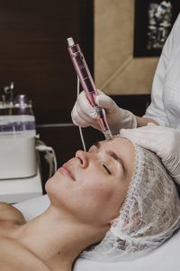 Tratamiento Dermapen en Embellece-t, Albacete, para rejuvenecer la piel, atenuar cicatrices y estimular la producción de colágeno.