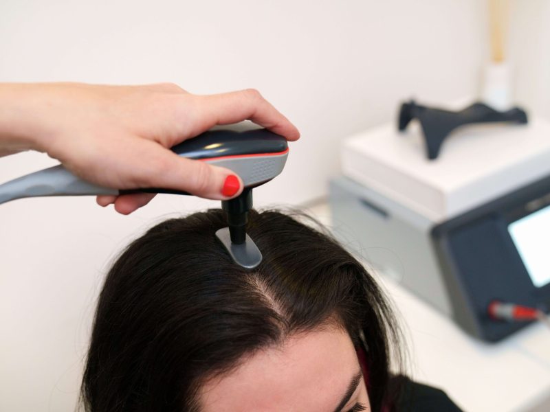 Tratamiento capilar con Indiba en Embellece-t, Albacete, para frenar la caída del cabello, fortalecer el cuero cabelludo y estimular el riego sanguíneo.
